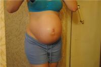 Фото ареолы при беременности